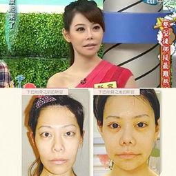 台湾节目爆料整容视频,揭秘明星整形真相